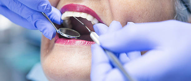 Best Knocked-Out Tooth Emergency  in Corona, CA